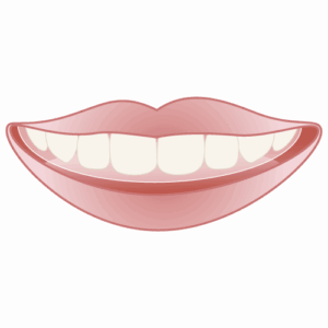 インビザライン