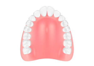 部分入れ歯(コンフォート)