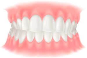 交叉咬合(こうさこうごう)