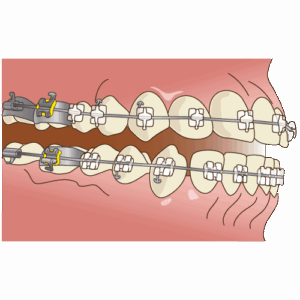 デーモンシステム